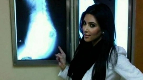 kim kardashian xray of butt for fans 2012