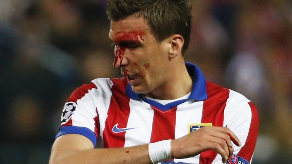 mario mandzukic bloodied up for champions league soccer 2015