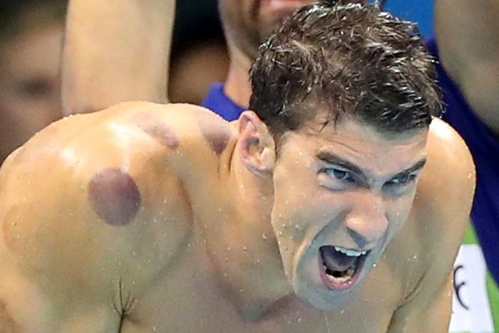 michael phelps shows cupping works