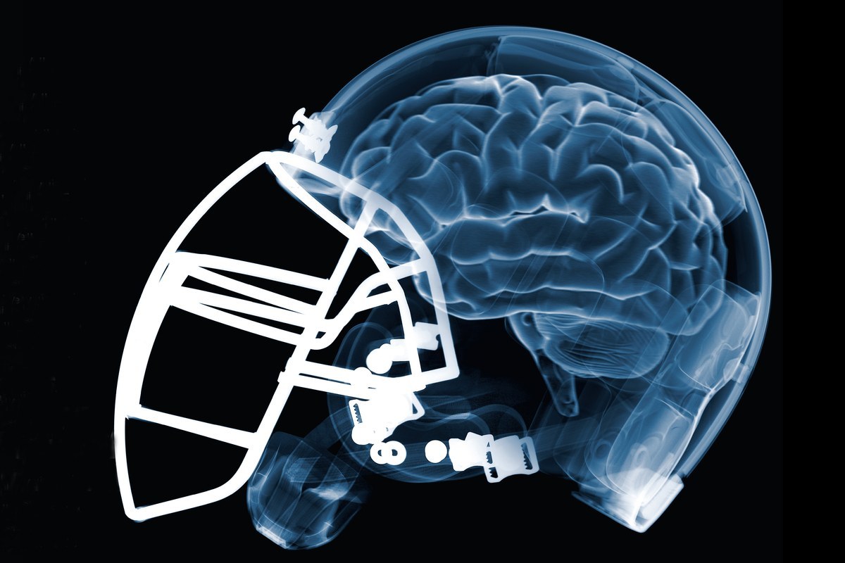 Concussion issues not settled yet for NFL | Movie TV Tech ...