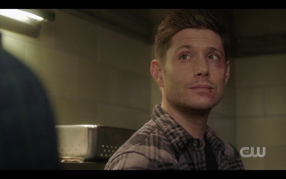 spn 1413 dean winchester beat up face would we be better off